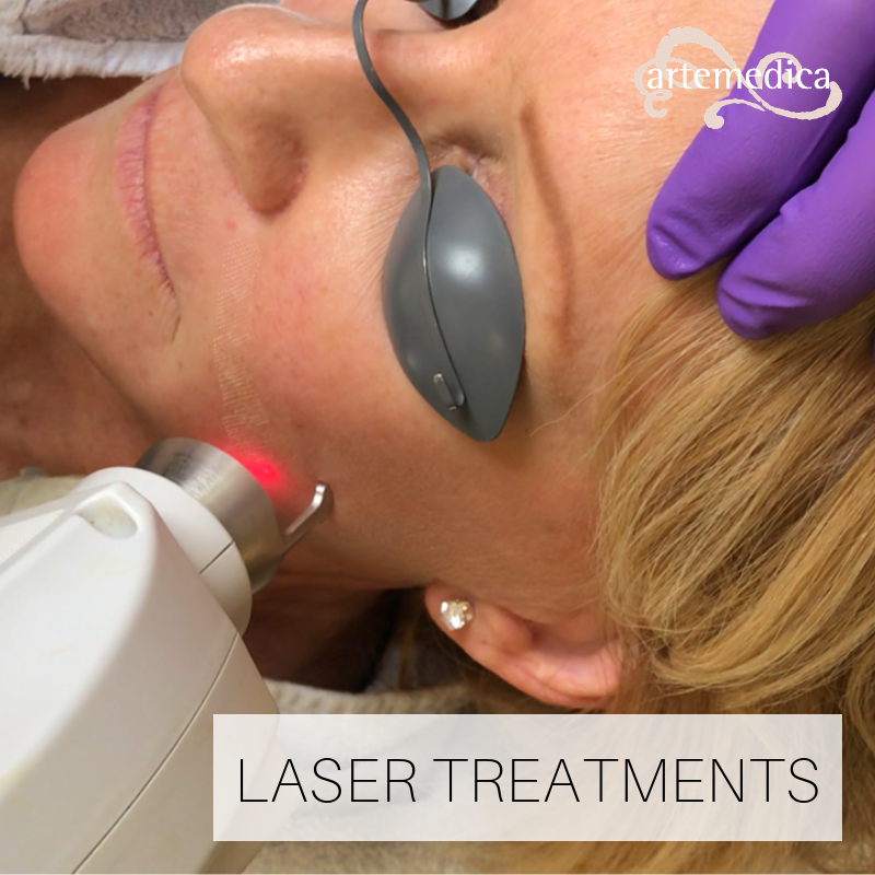 Everything you Need to Know About Laser Facial Treatment