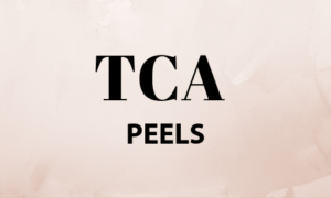 TCA peels