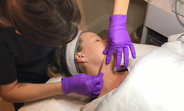 Esthetician using dermaplaning with illuminize peel facial treatment on client's cheek