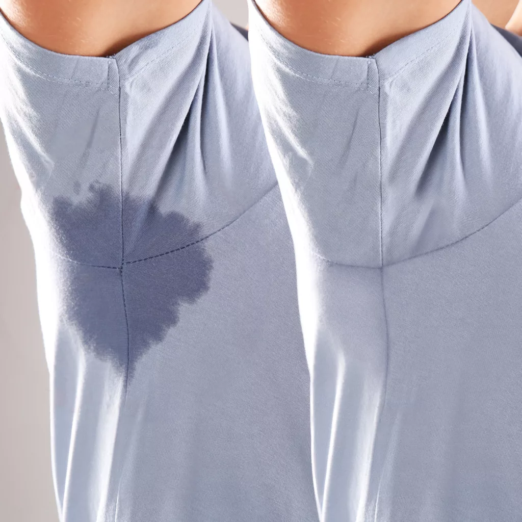 before and after Brella SweatControl Patch to address excessive underarm sweating.