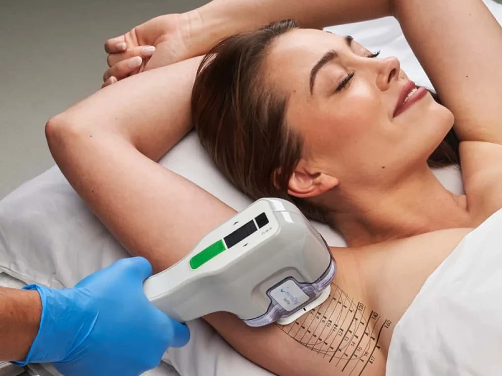 miraDry: the only FDA-approved non-invasive treatment scientifically proven to disable underarm sweat glands for good!