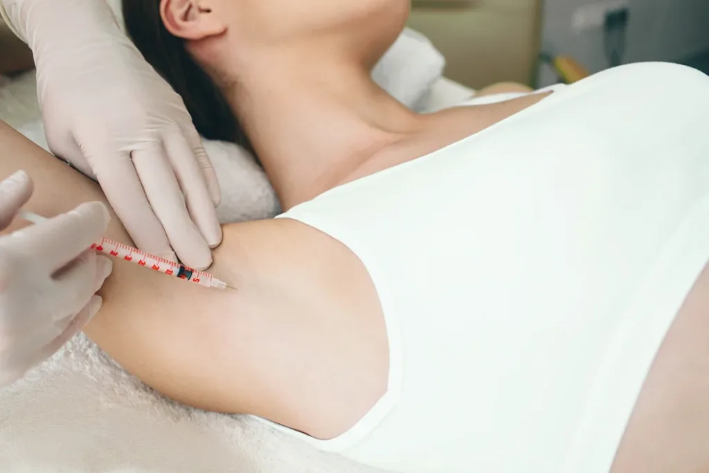 A close-up of a botox injection in the armpit for hyperhidrosis treatment